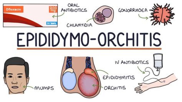 Which antibiotics for epididymo-orchitis?