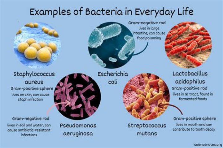 Which bacteria is a reason of earth odor?