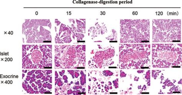 Which collagenase for tissue digestion?