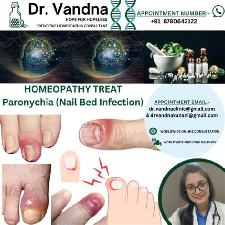 Which doctor treats paronychia?