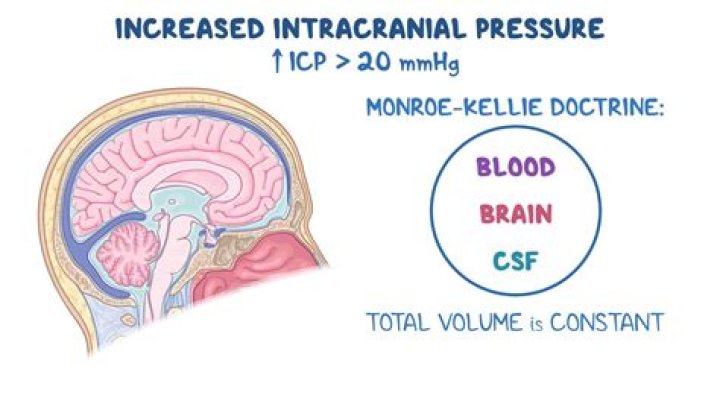 Which drugs cause intracranial pressure?