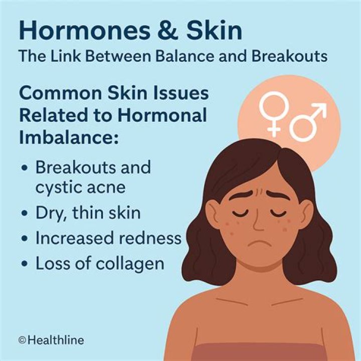Which hormone causes oily skin?