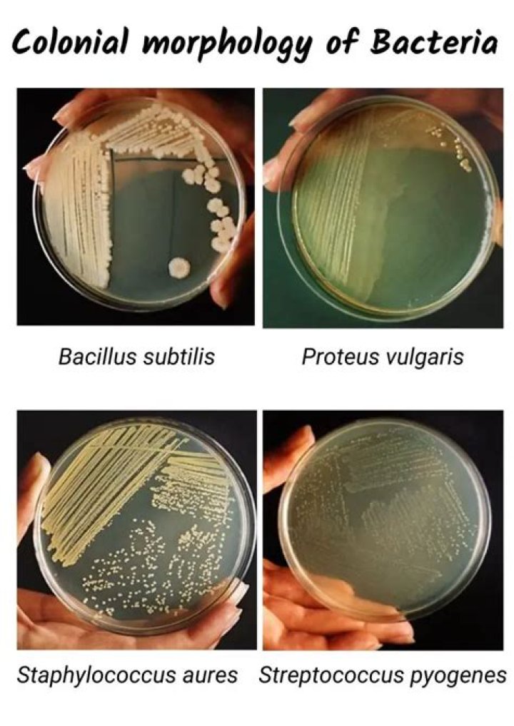 Which is a bacterial colony?