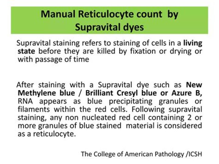 Which is considered as a supravital stain?