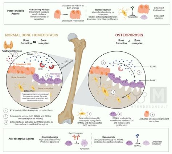 Which is idiopathic osteoporosis?