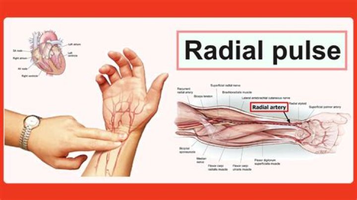 Which is radial pulse?