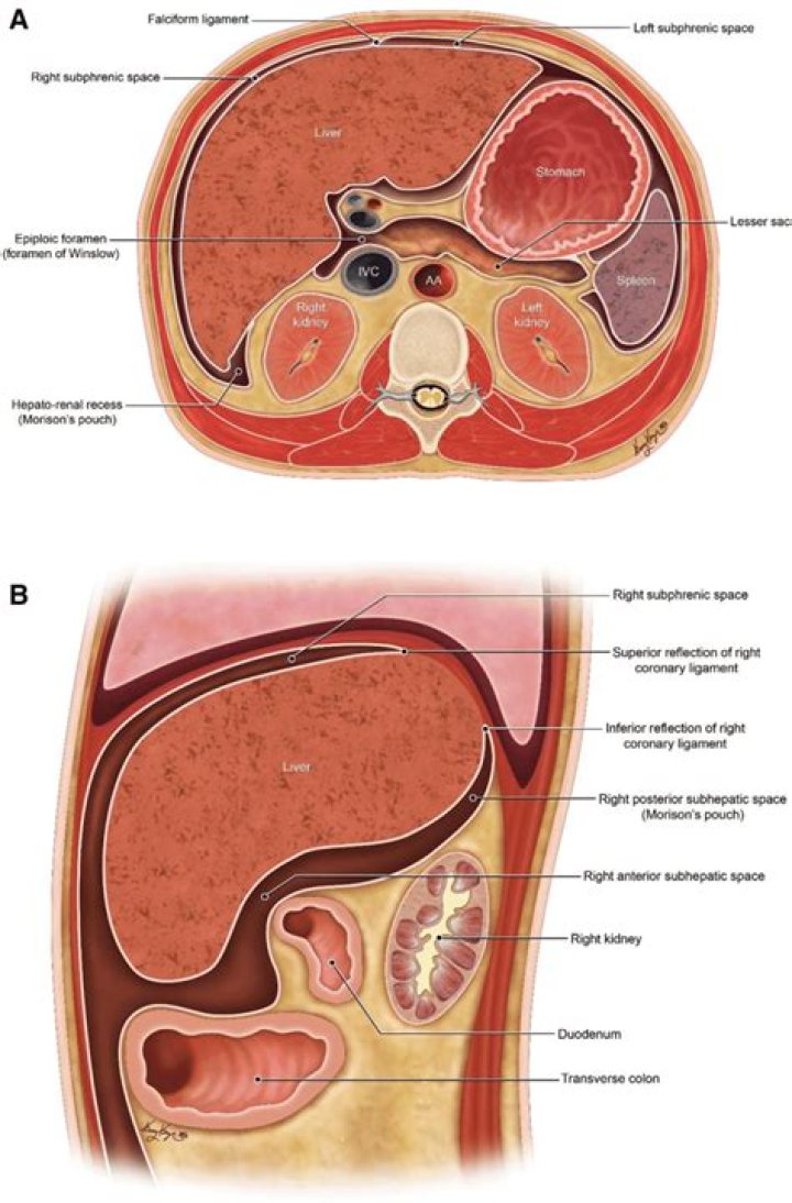 Which is the epiploic foramen?