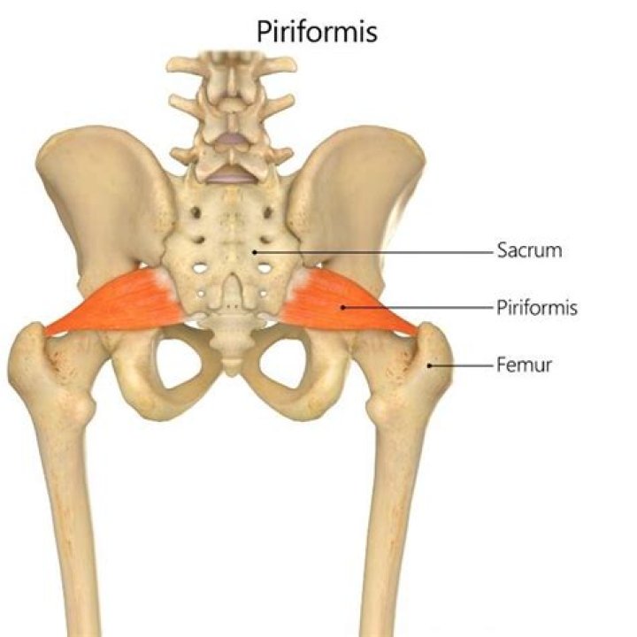 Which is the insertion of the piriformis?