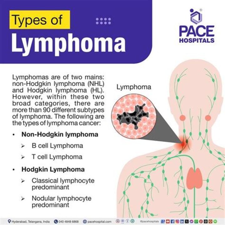 Which lymphomas are indolent?