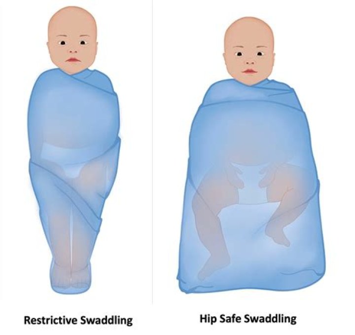 Which method of swaddling could cause injury?