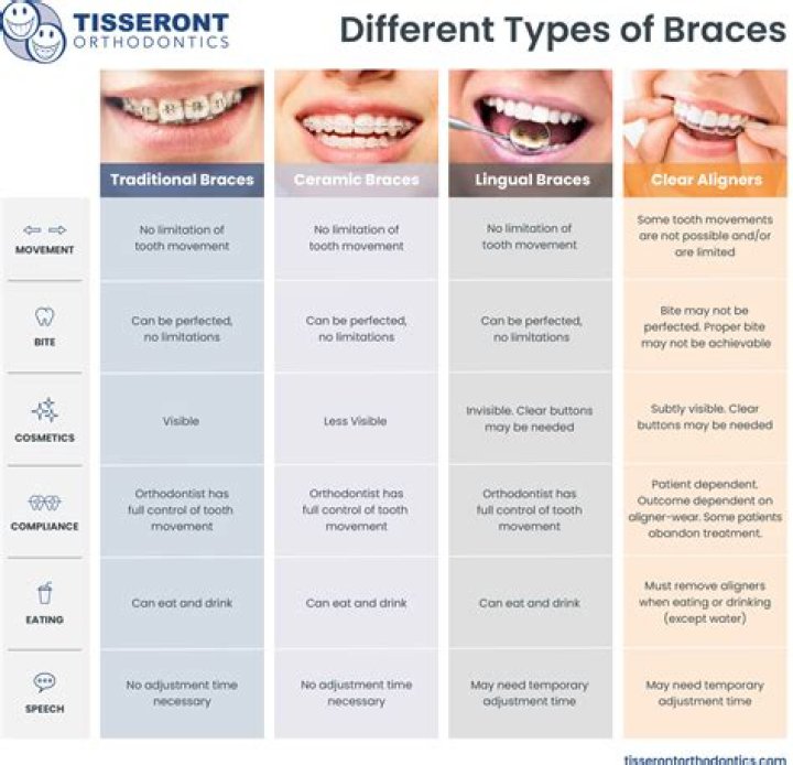 Which orthodontics is best?
