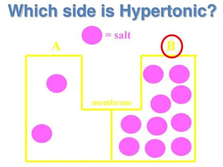 Which side is hypertonic?