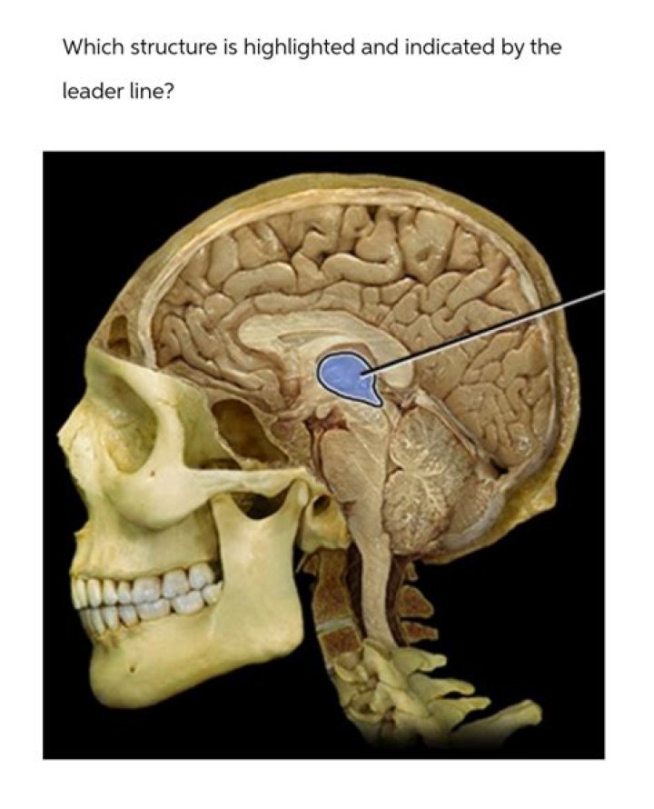 Which structure is highlighted and indicated by the leader line?