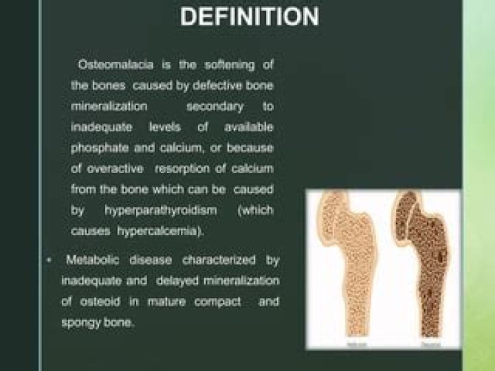 Which term means softening of bones?