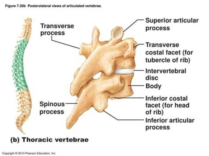 Which vertebrae have long spinous process?