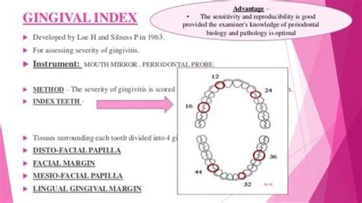 Who developed the gingival index?