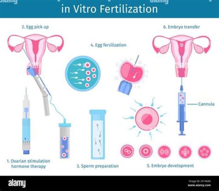 Who discovered in vitro fertilization?