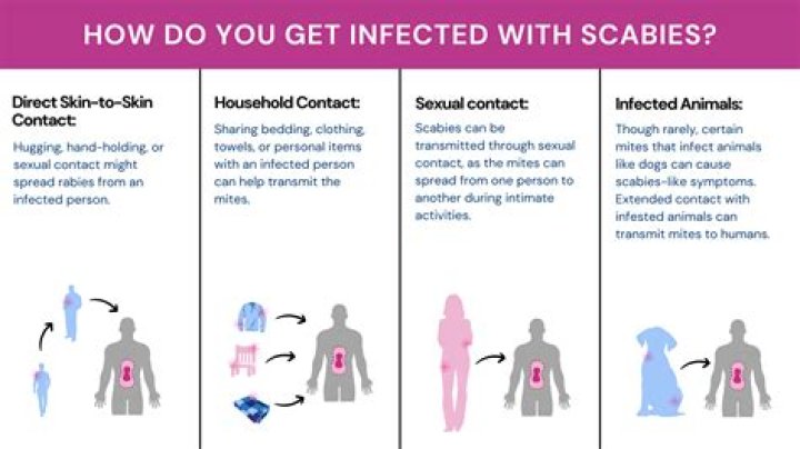 Who do you contract scabies?