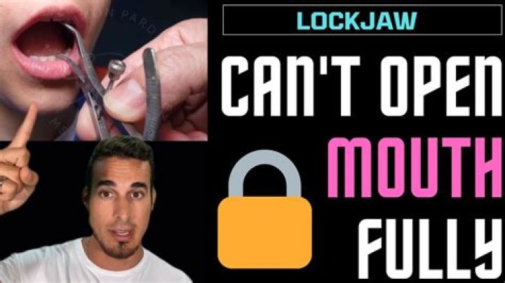 Who do you see for lockjaw?