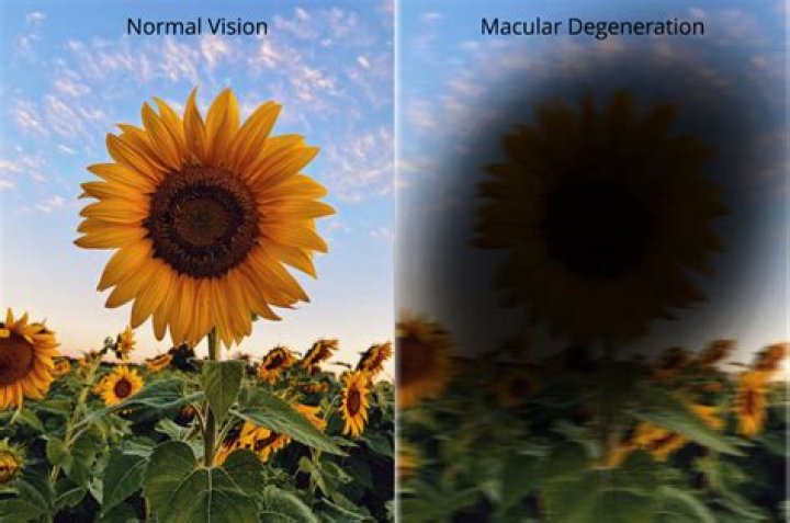 Who does eyesight deteriorate?