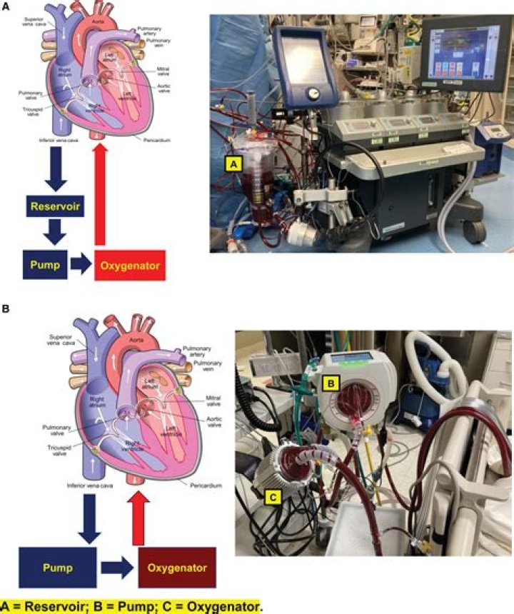 Who is a cardiopulmonary perfusionist?