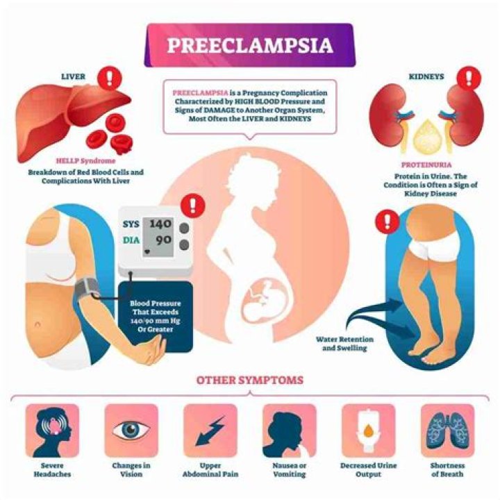 Who management of pre eclampsia?
