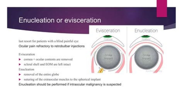 Who performs eye enucleation?