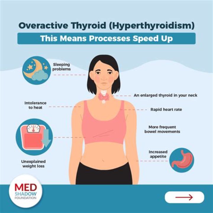 Who specializes in thyroid issues?