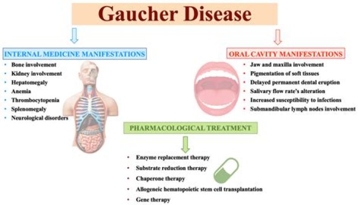 Who treats gaucher disease?