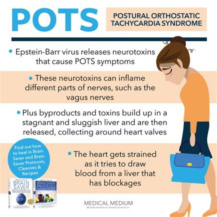 Who treats pots syndrome?
