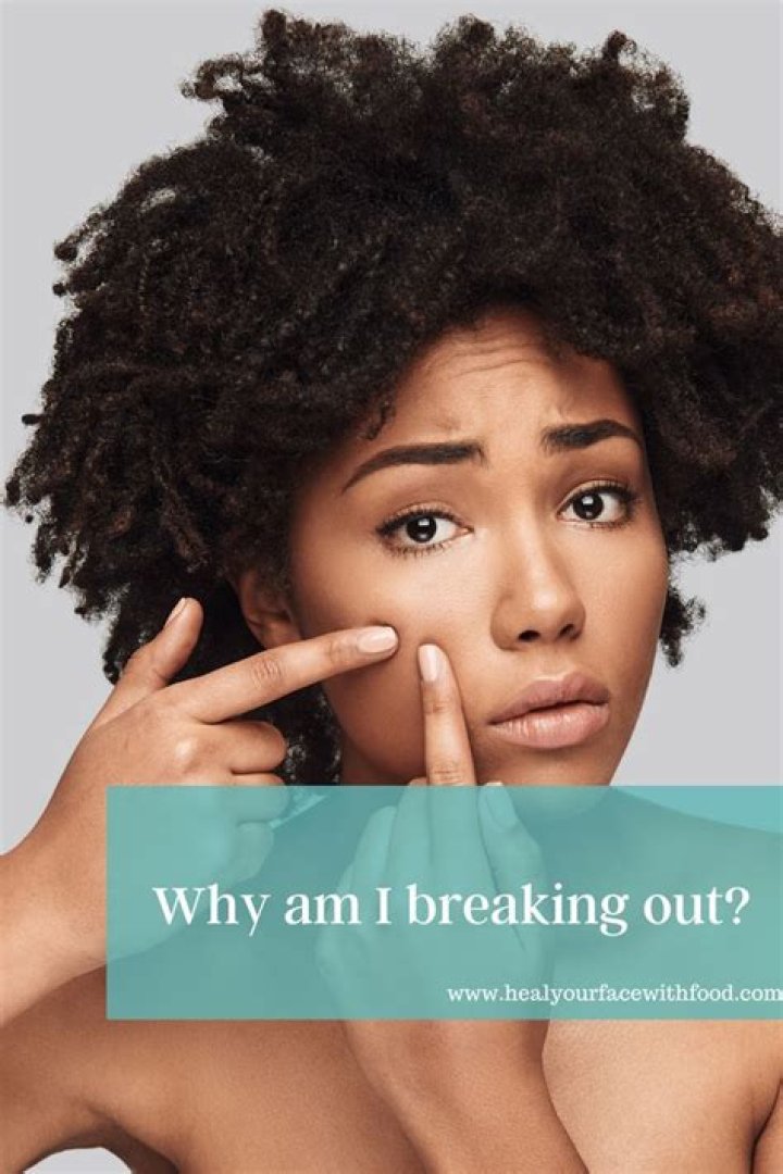 Why am i breaking out on my back?