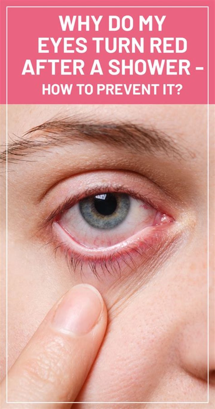 Why are moops eyes red?