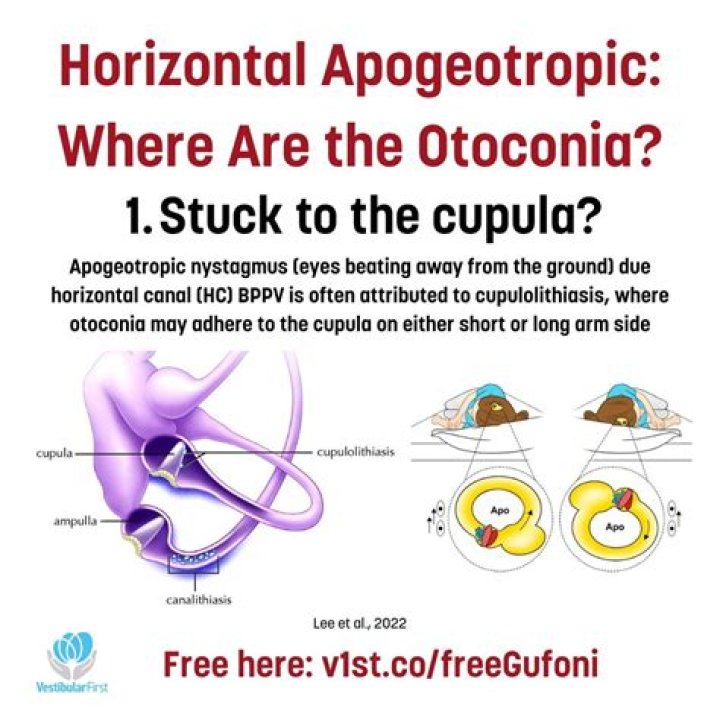 Why are otoconia important?
