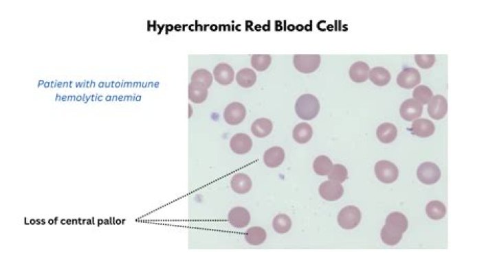Why are red blood cells pale in the middle?
