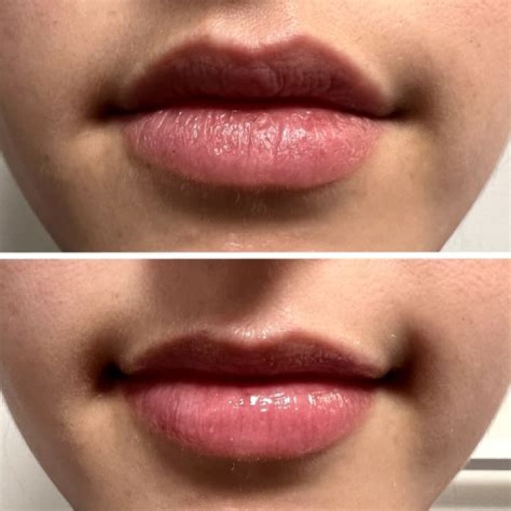 Why are some lip balms drying?