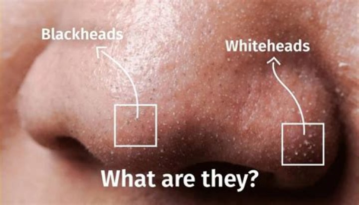 Why are there so many thrips?