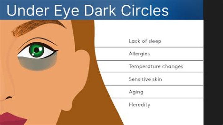 Why around my eyes skin is dark?
