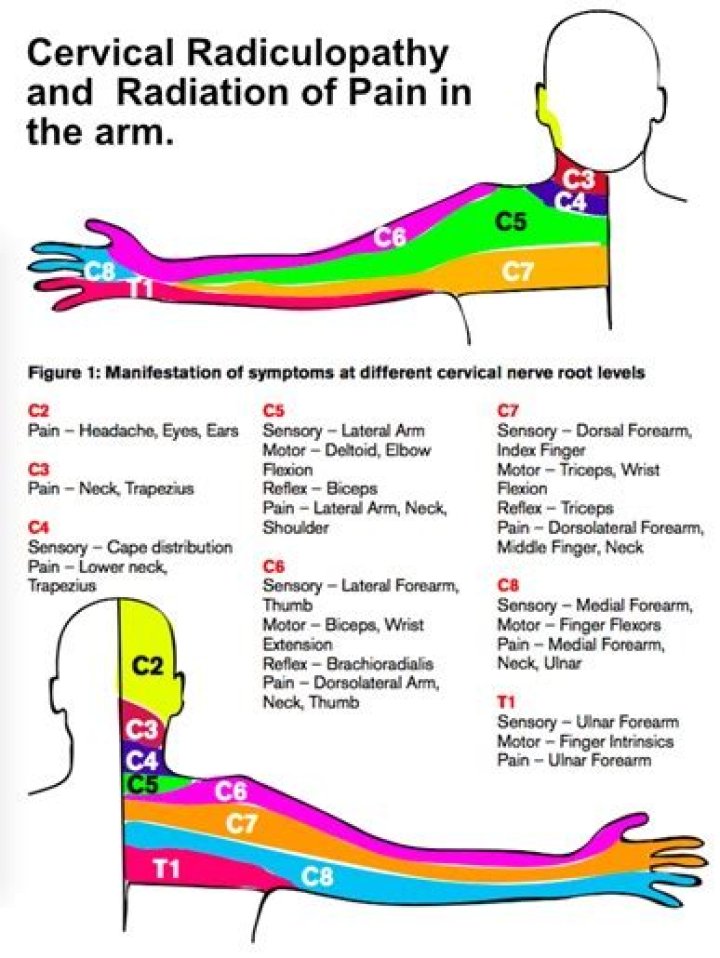 Why chest pain radiating to left arm?