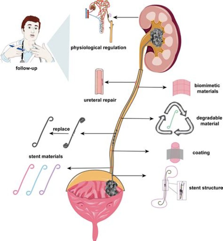 Why constriction of ureter?