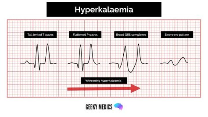 Why do burns cause hyperkalemia?