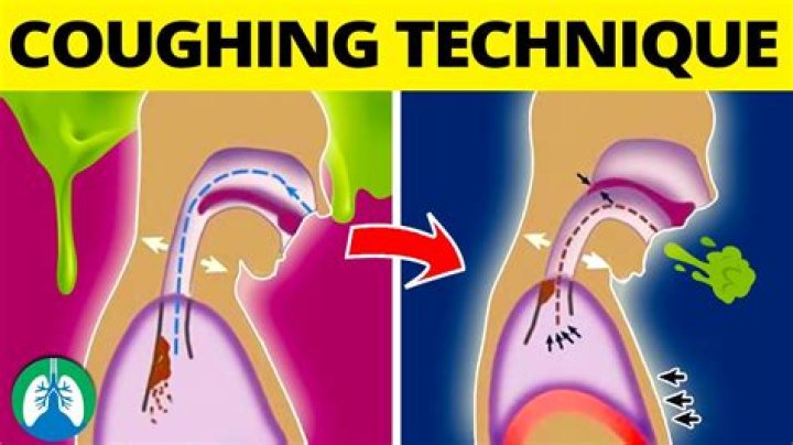 Why do i have a throaty cough?