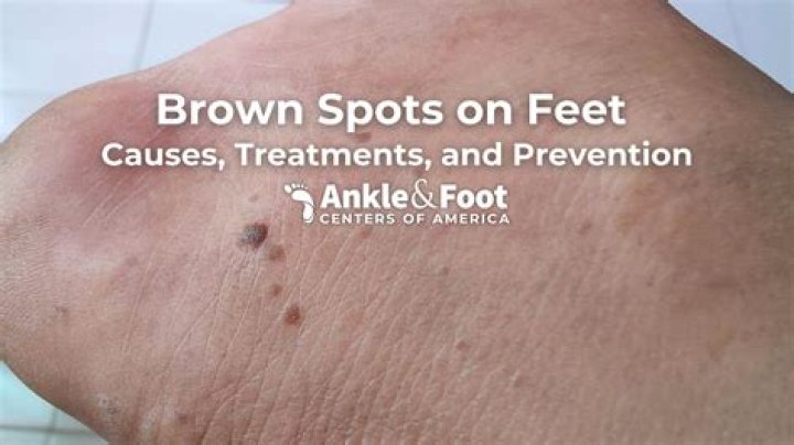 Why do i have under skin spots?