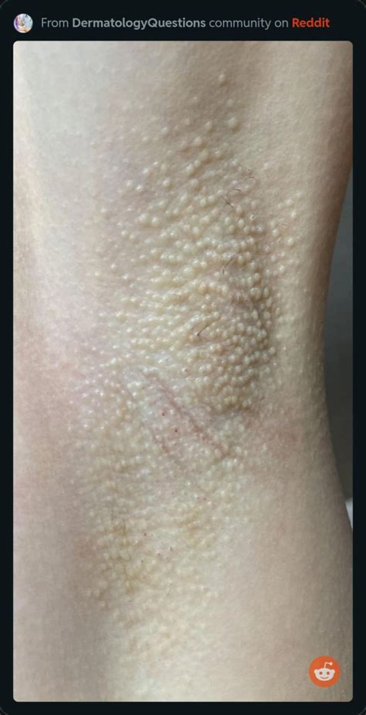 Why do my underarms hurt?