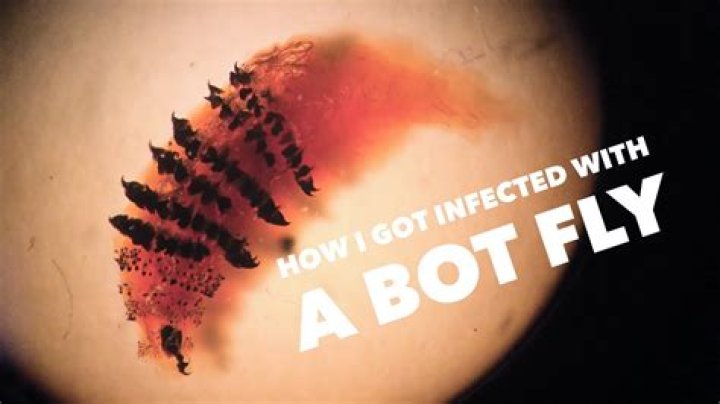 Why does a botfly get inside you?