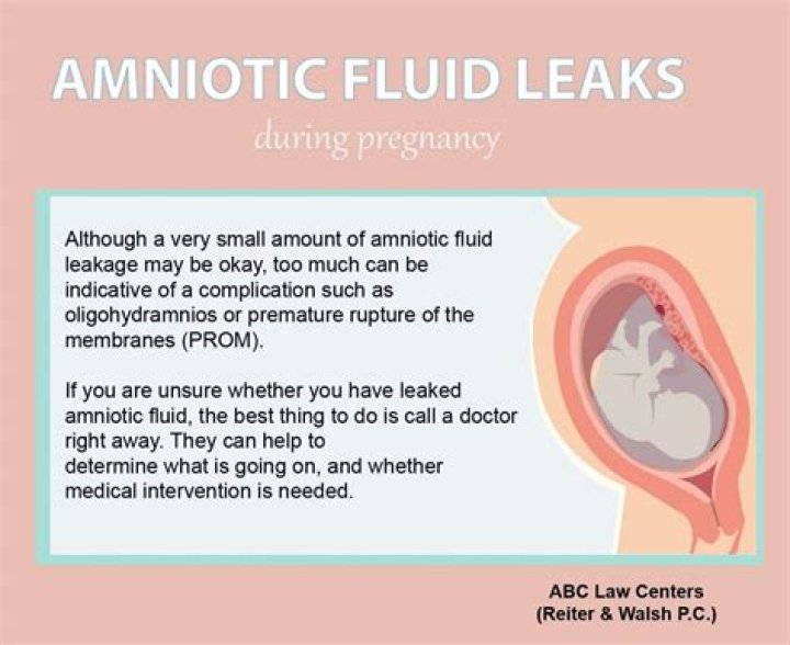 Why does the amniotic sac break?