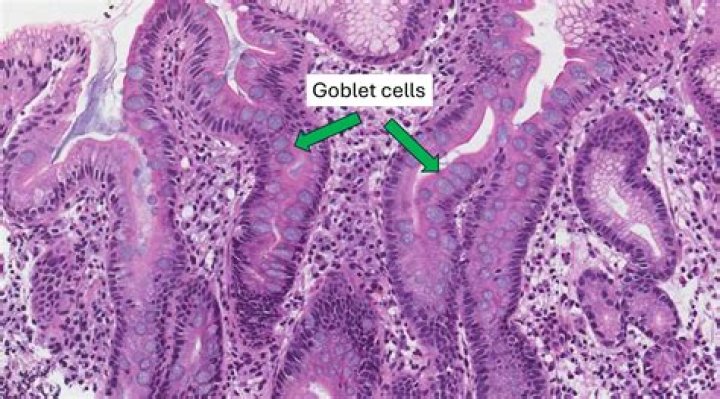 Why does the ileum do?