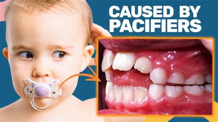 Why dummies are bad for babies?
