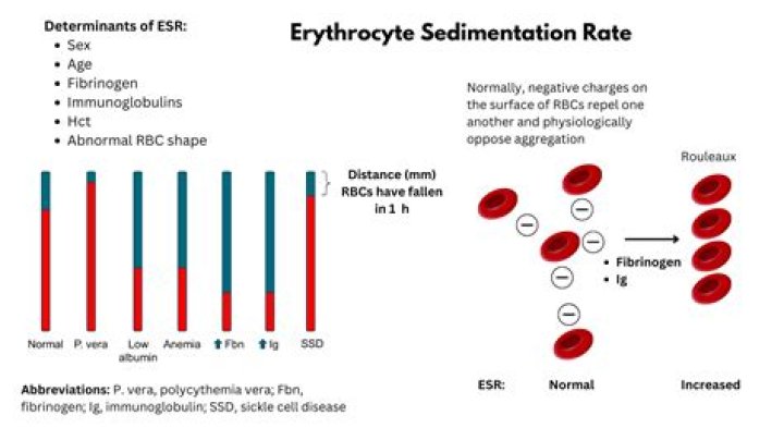 Why erythrocyte sedimentation rate increases?