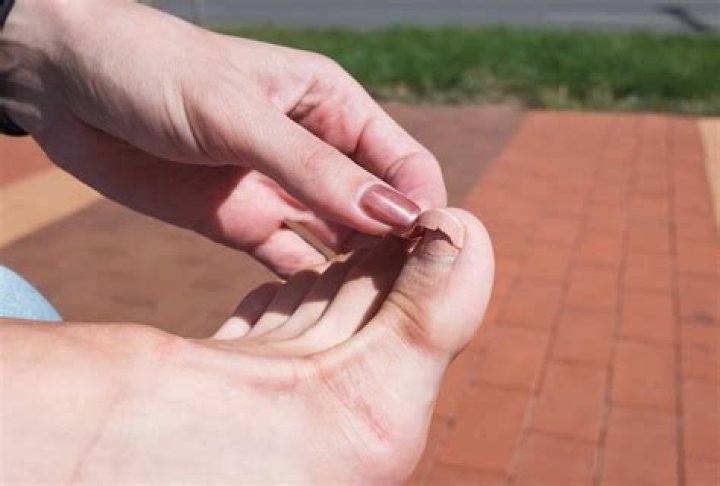 Why hitting off toe?