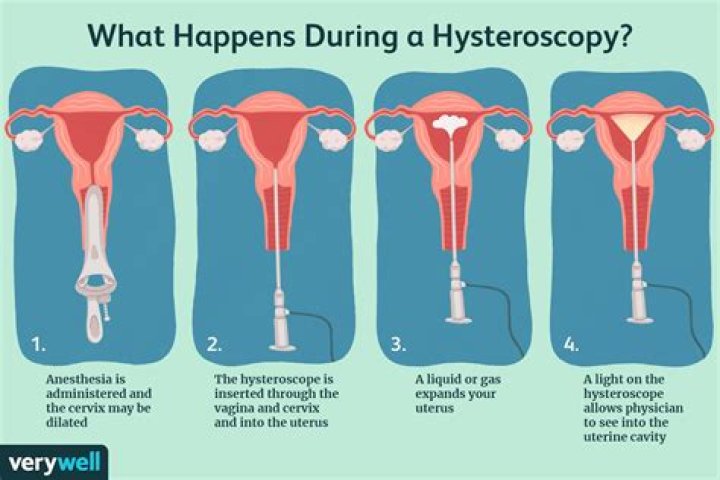 Why hysteroscopy is needed?